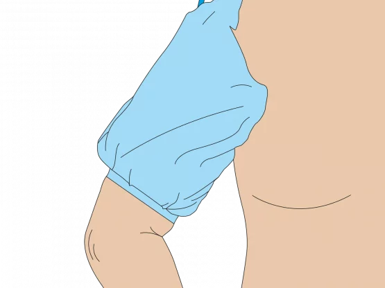 Manschetten-Drape Arm für Tourniquet, unsteril