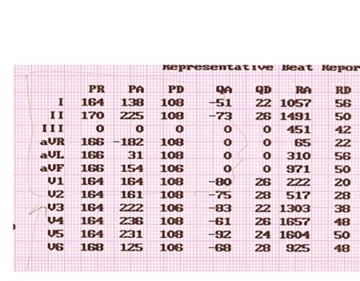 EKG Papier für Cardio-M / Cardio M Plus
