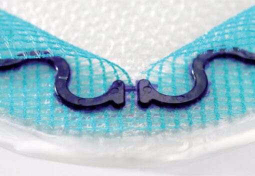 Parietex Composite Ventral, ein Netz, Fixations- und Einführsystem zur Anwendung bei kleinen ventralen Hernienreparationen.