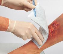 Vliwaktiv, Aktivkohle-Saugkompresse